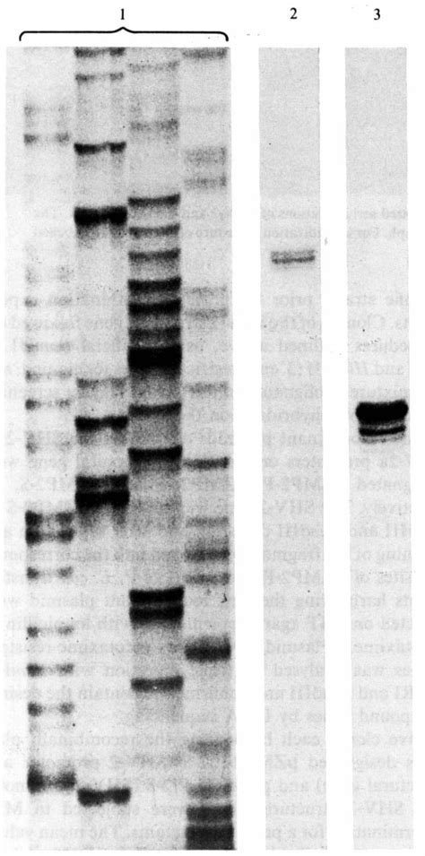 Example Of An S1 Nuclease Digestion Assay For The Assessment Of The Download Scientific Diagram