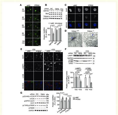 Ugcg Deficient Cardiomyocytes Have Impaired Endolysosomal Function And