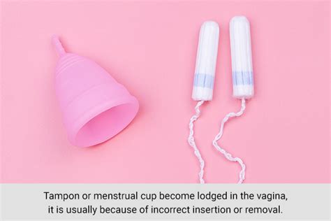 Facts About The Vagina You Probably Didnt Know