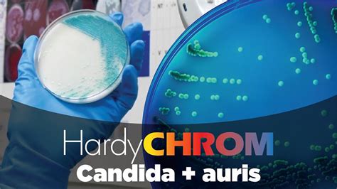 Hardychrom Candida Auris Chromogenic Media Youtube