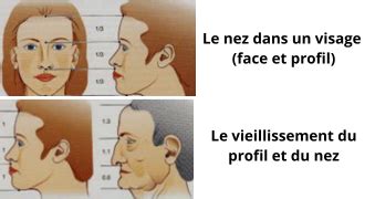 Se Refaire Le Nez Sans Chirurgie Par Injections Correctrices