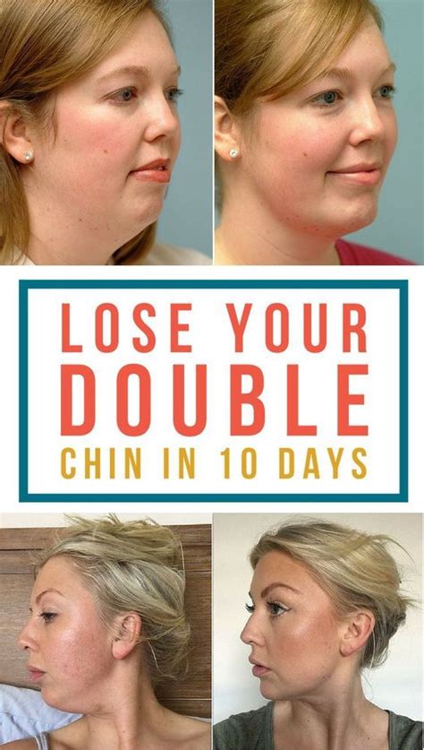 How To Get Rid Of A Double Chin The Quick And Easy Way Wellness Click