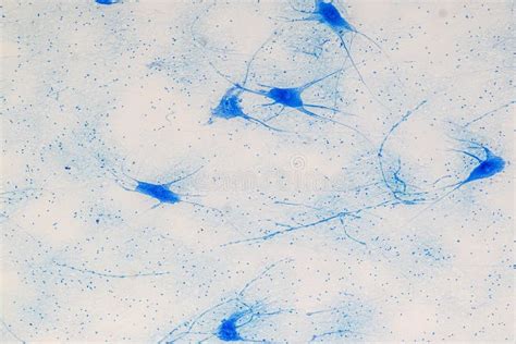 Motor Neuron Under The Microscope Stock Image Image Of Eosin