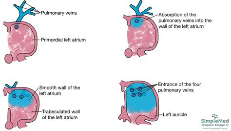 6 Embryology Of The CVS SimpleMed Learning Medicine Simplified