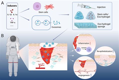 Application Of Stem Cells And Stem Cell Derived Exosomes For Wound Download Scientific Diagram