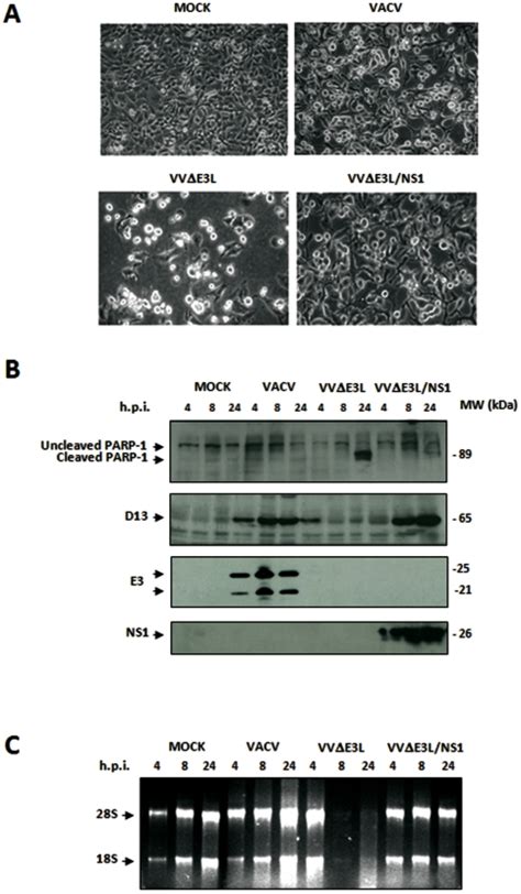 A Morphological Changes In Hela Cells Mock Infected Or Infected With