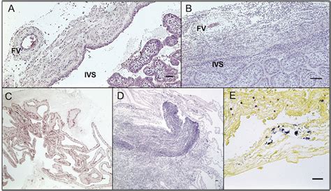 Fetal Membranes Histology