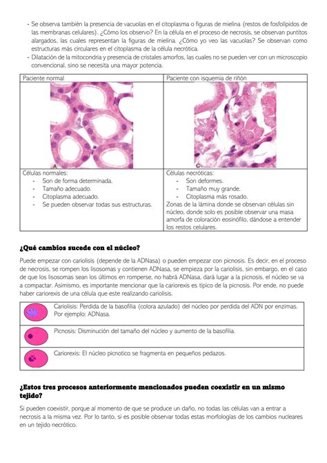 Solution Patologia General Patologia Celular Necrosis Y Apoptosis