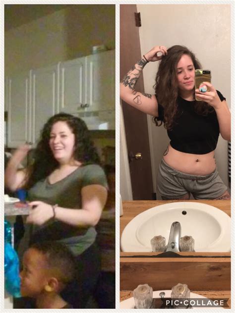 Extreme Weight Loss After Gallbladder Surgery at Mary Bilbo blog