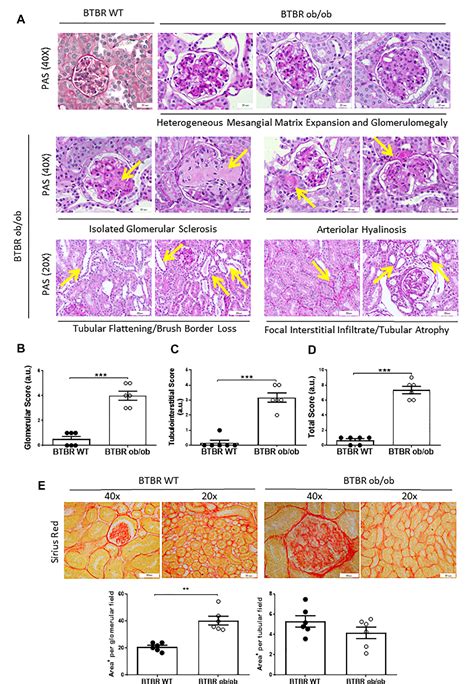 Figure From Kidney Microrna Expression Pattern In Type Diabetic