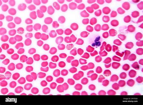 Human blood smear under microscope, light photomicrograph showing red ...