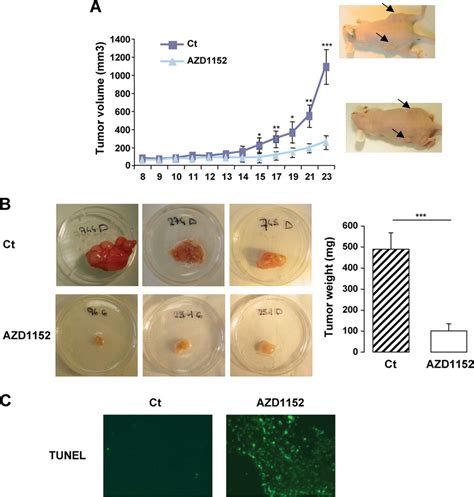 In Vivo Anti Tumor Effect Of The Aurora B Inhibitor AZD1152 A A375