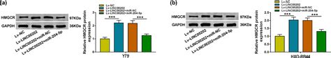 Linc Promotes Retinoblastoma Progression By Regulating Cell