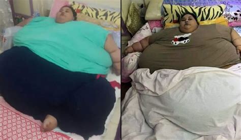 Eman Ahmed Worlds Heaviest Woman Finally Has Hopes Of Living Normal