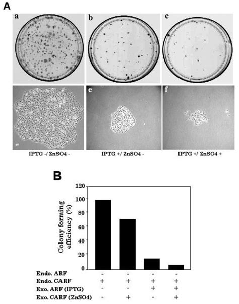 Inducible Expression Of CARF With ARF Results In Reduced Colony Forming