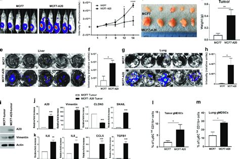 A20 Overexpression Promotes Aggressive Metastatic Properties In Mouse