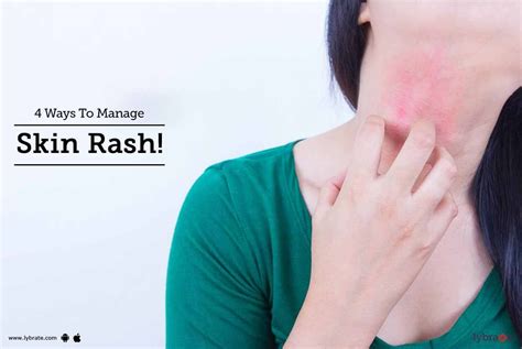 4 Ways To Manage Skin Rash! - By Dr. Archit Aggarwal | Lybrate