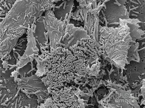 Sem Of Smegma Photograph By Scimat