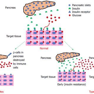 Schematic Representation Differentiating Between Normal And Diabetic