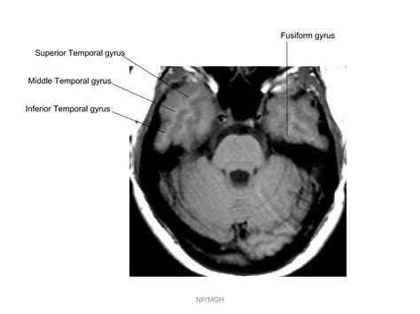 Ppt Parietal Lobe Ppt