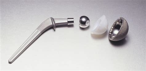 Stryker Hip Replacement Lawsuit Filed By Alabama Couple