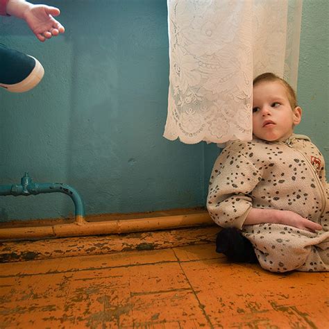 Igor Was Abandoned As A Baby Because Of His Disabilities Chernobyl