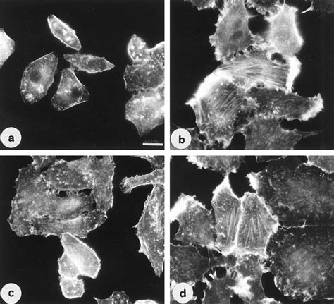 Escherichia Coli Cytotoxic Necrotizing Factor Cnf A Toxin That