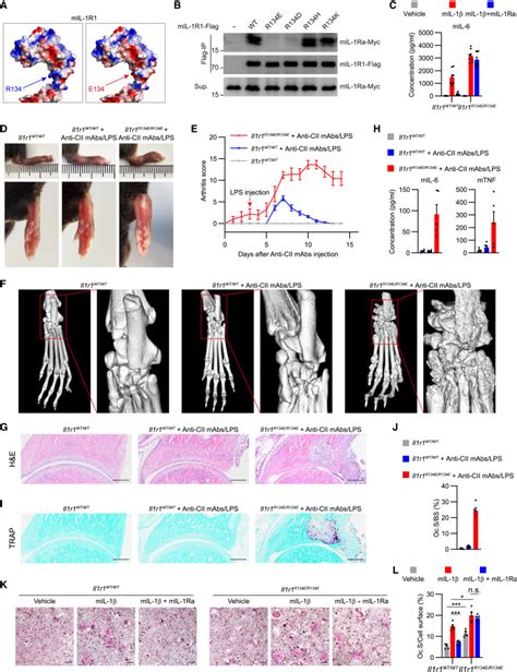 Identification Of An IL 1 Receptor Mutation Driving Autoinflammation