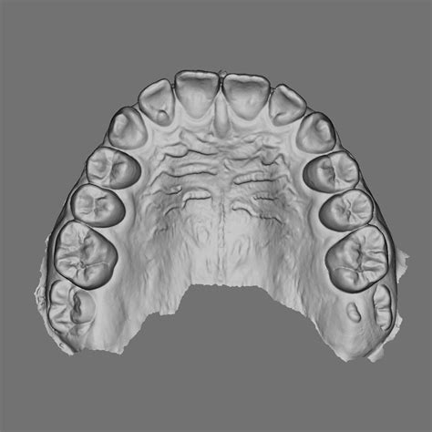 Free Stl File Superior Maxillary From Intraoral Scan Area D Patient