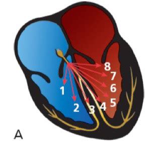 Ecg Lecture Cardiac Axis Hypertrophy And Enlargement Flashcards