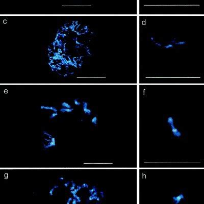 Fluorescent In Situ Hybridization FISH Using RDNA Probes On