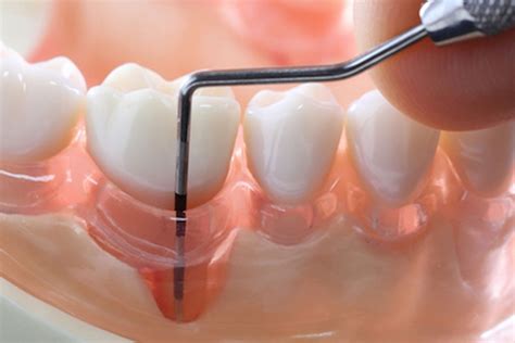 Prodental Novi Beograd De Urni Stomatolog Snimanje Zuba D