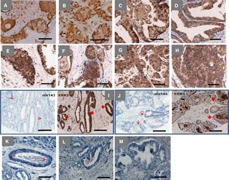 Extracellular Signal Regulated Protein Kinase 5 Protein And Mir143