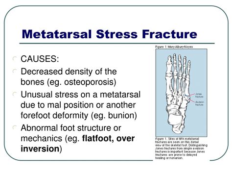 Ppt Comprehensive Guide To Lower Leg And Ankle Injuries Treatment