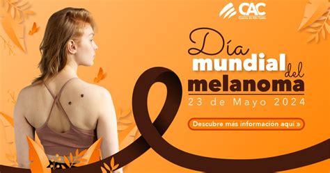 Día Mundial Del Melanoma 2024 Cuenta De Alto Costo