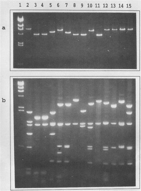 Ethidium Bromide Stained Agarose Gels Containing Vir Regulon Pcr