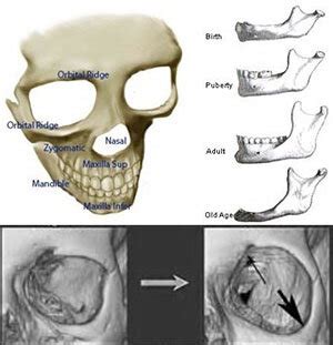 faceskin remodeling  looksmaxxingskinmaxxing  improve facial