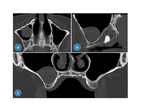 Indicazioni Per Un Uso Consapevole Della Cbct In Odontoiatria Dm Il