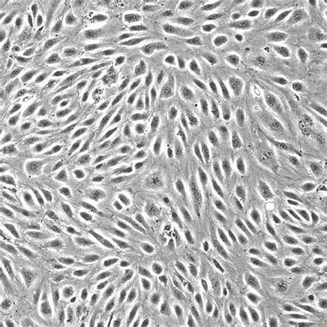 Human Cervical Microvascular Endothelial Cells Innoprot Cervix Cells