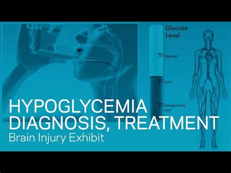 Hypoglycemia Diagnosis And Treatment Ac