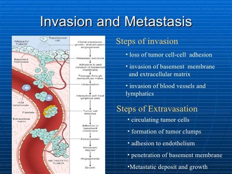 2 Pathological Diagnosis Of Cancer