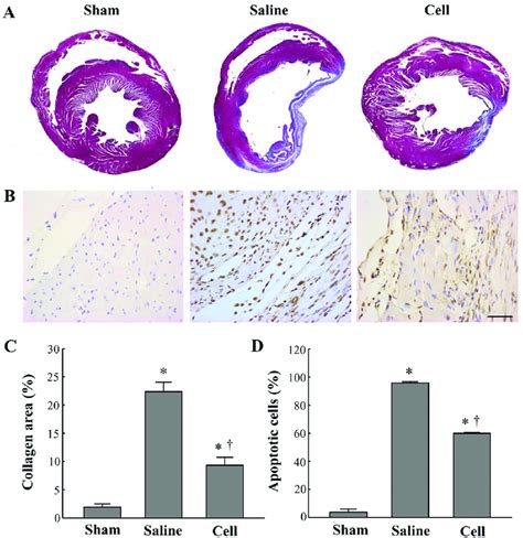 BM MSC Therapy Improves Fibrosis And Apoptosis In A Rat Model Of MI