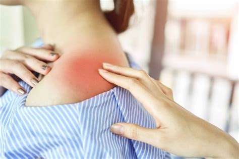 Non Surgical Treatment for Rotator Cuff Tear