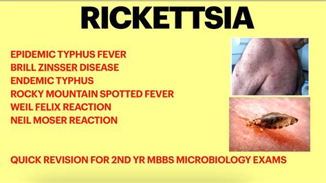 Rickettsia Microbiology Typhus Fever Weil Felix Test Rickettsial