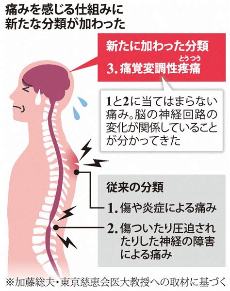 原因不明で長引くのは「第3の痛み」 脳回路が影響？ 治療法に期待 毎日新聞