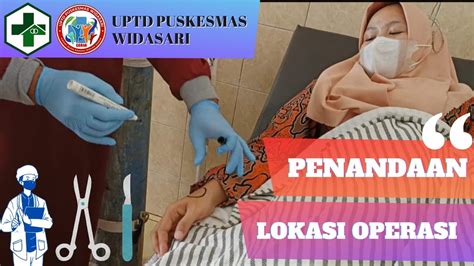 Simulasi Penandaan Lokasi Operasi Uptd Puskesmas Widasari Youtube