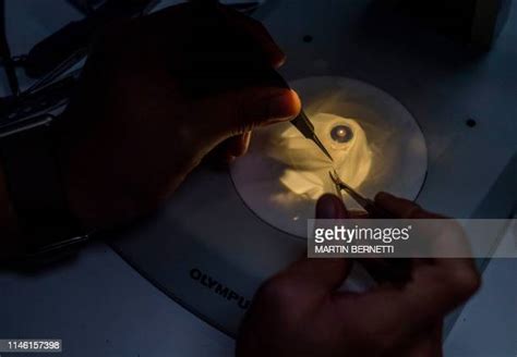 Ophthalmic Surgery Photos and Premium High Res Pictures - Getty Images