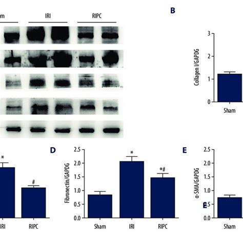 Expression Of Collagen I Collagen Iii Fibronectin And A Sma Assessed