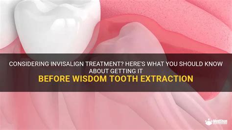 Considering Invisalign Treatment Here S What You Should Know About