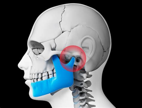 Temporomandibular Joint Disorder Tmd Or Tmj Tmj Treatment In